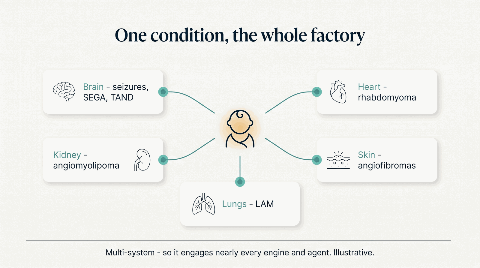 One condition, the whole factory — TSC across brain, heart, kidney, skin, and lungs